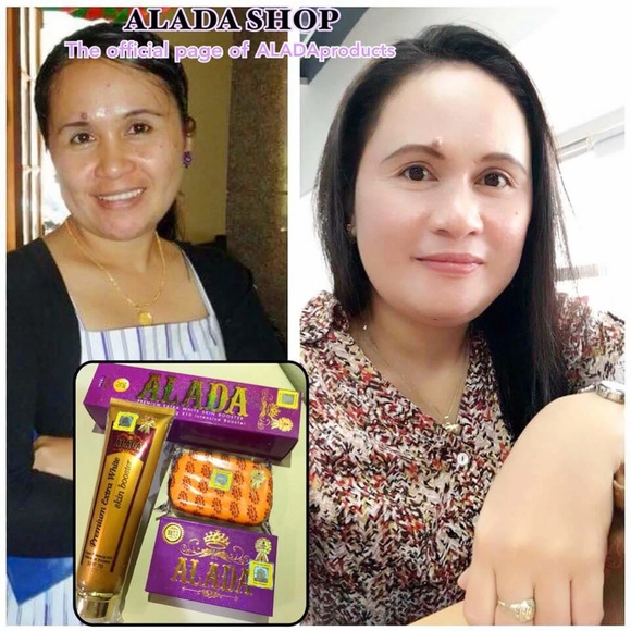 ALADA Set - Picture 1 of 1